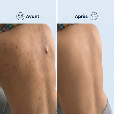 Serviette Exfoliante Japonaise | Peau Douce & Radieuse