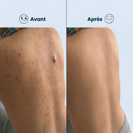 Serviette Exfoliante Japonaise | Peau Douce & Radieuse