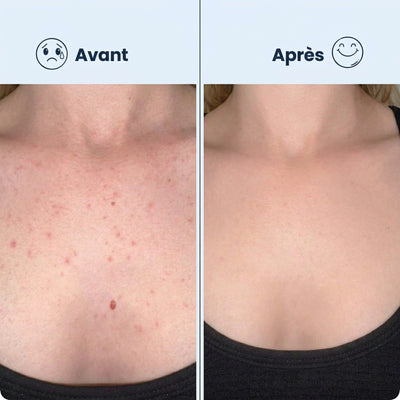 Serviette Exfoliante Japonaise | Peau Douce & Radieuse