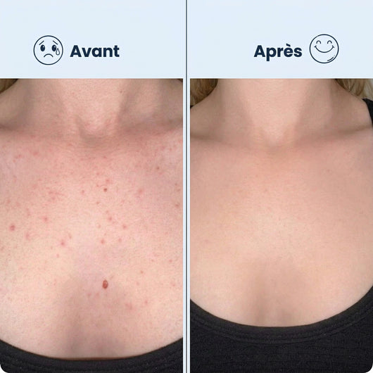 Serviette Exfoliante Japonaise | Peau Douce & Radieuse