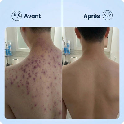 Serviette Exfoliante Japonaise | Peau Douce & Radieuse