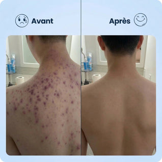 Serviette Exfoliante Japonaise | Peau Douce & Radieuse