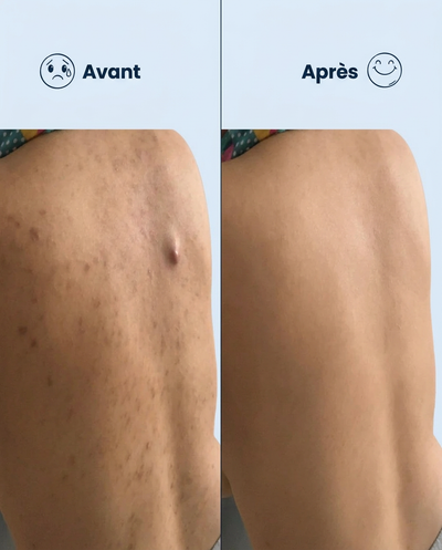 Serviette Exfoliante Japonaise | Peau Douce & Radieuse